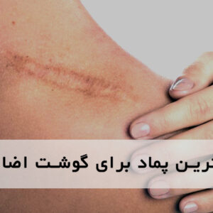 بهترین پماد برای گوشت اضافه